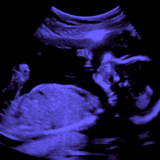 Baby Twamley